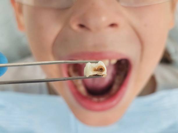  Rocky Top, TN Emergency Dentist Pros
